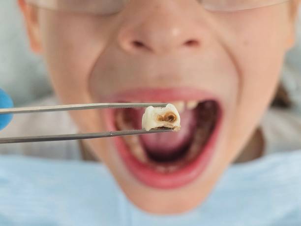 Best Weekend Emergency Dentist in North Les, AK